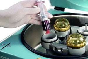 Centrifuge met bloedbuisjes voor de bereiding van ACP bloedplasma: het bloed wordt gecentrifugeerd om een concentraat van bloedplaatjes en groeifactoren te verkrijgen
