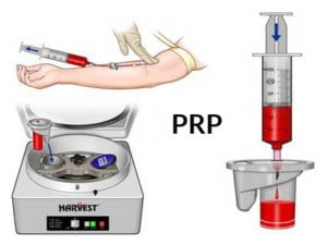 PRP protocol