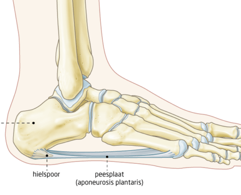 Hielspoor anatomie