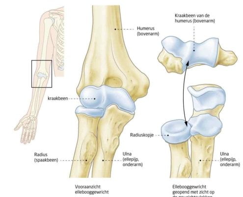 Elleboogklachten