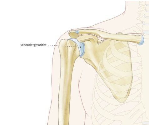 schouderklachten