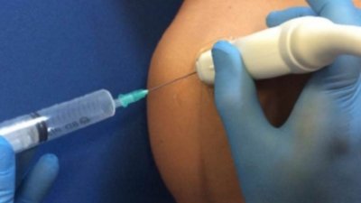Echogeleide cortisone injectie in de peesschede van de bicepspees bij biceps tendinitis