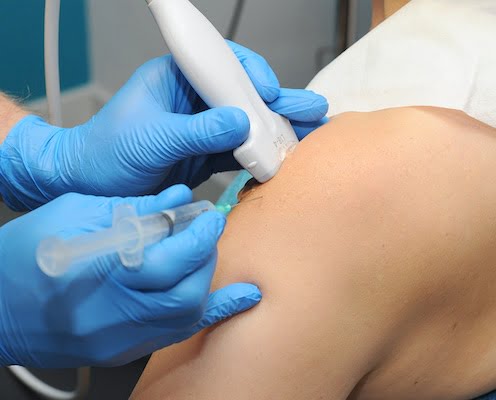 Echogeleide cortisone injectie