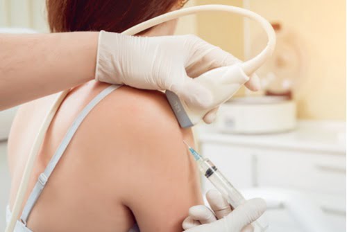 Echogeleide cortisone injectie in de schouder bij Orthozorg: orthopeed en echografist werken samen tijdens hetzelfde consult