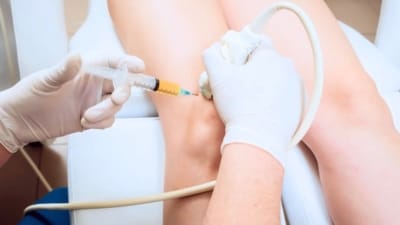 PRP Echogeleide injectie