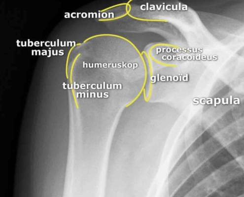 rontgenfoto van een normale schouder