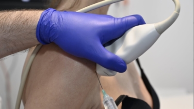 Echogeleide cortisone-injectie bij een peesontsteking in de schouder: de naald wordt onder echogeleiding precies in de slijmbeurs geplaatst, niet in de pees zelf