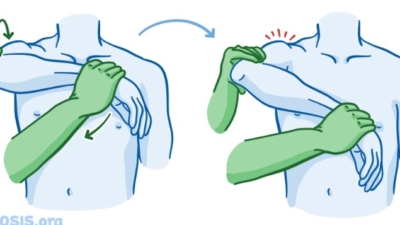 Hawkins-Kennedy test