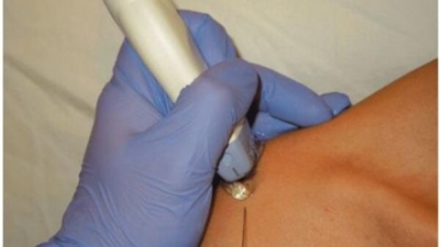 ac gewricht injectie