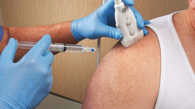 cortisone-injectie-tendinitis-calcarea