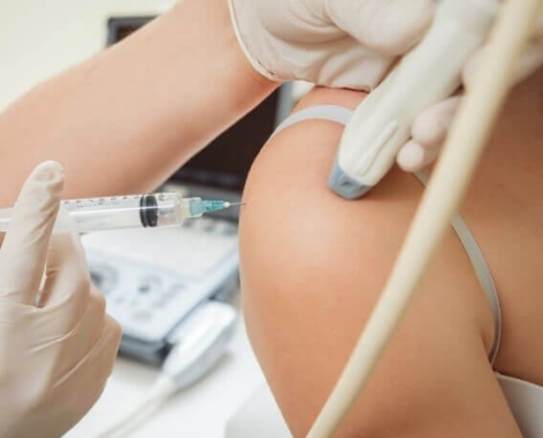 frozen-shoulder-injectie-orthozorg