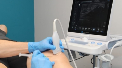 Echogeleide hyaluronzuur injectie in de knie bij Orthozorg, naald zichtbaar onder real-time echogeleiding