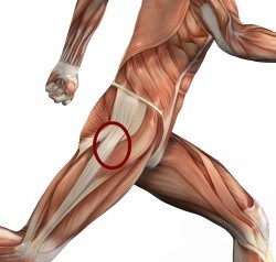 Anatomische illustratie van hardloper met rode cirkel op pijnpunt aan buitenzijde heup ter hoogte van trochanter major